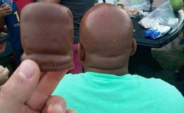 Adamın Kel Kafası ve Çikolata