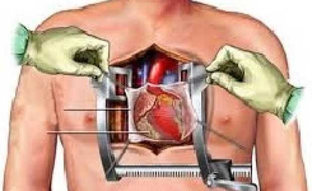 Kalp Cerrahı