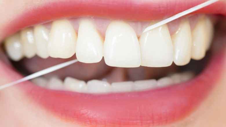 Evde Diş Beyazlatmak İçin 10 Basit İpucu