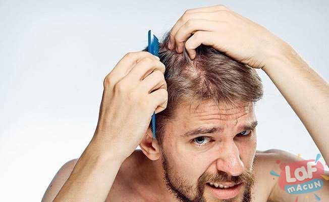Erkeklerde saç dökülmesi sebepleri