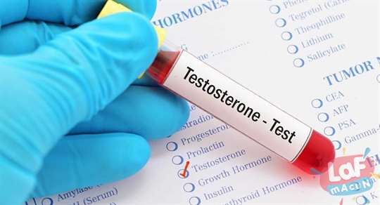 Testosteron düşüklüğü neden olur?