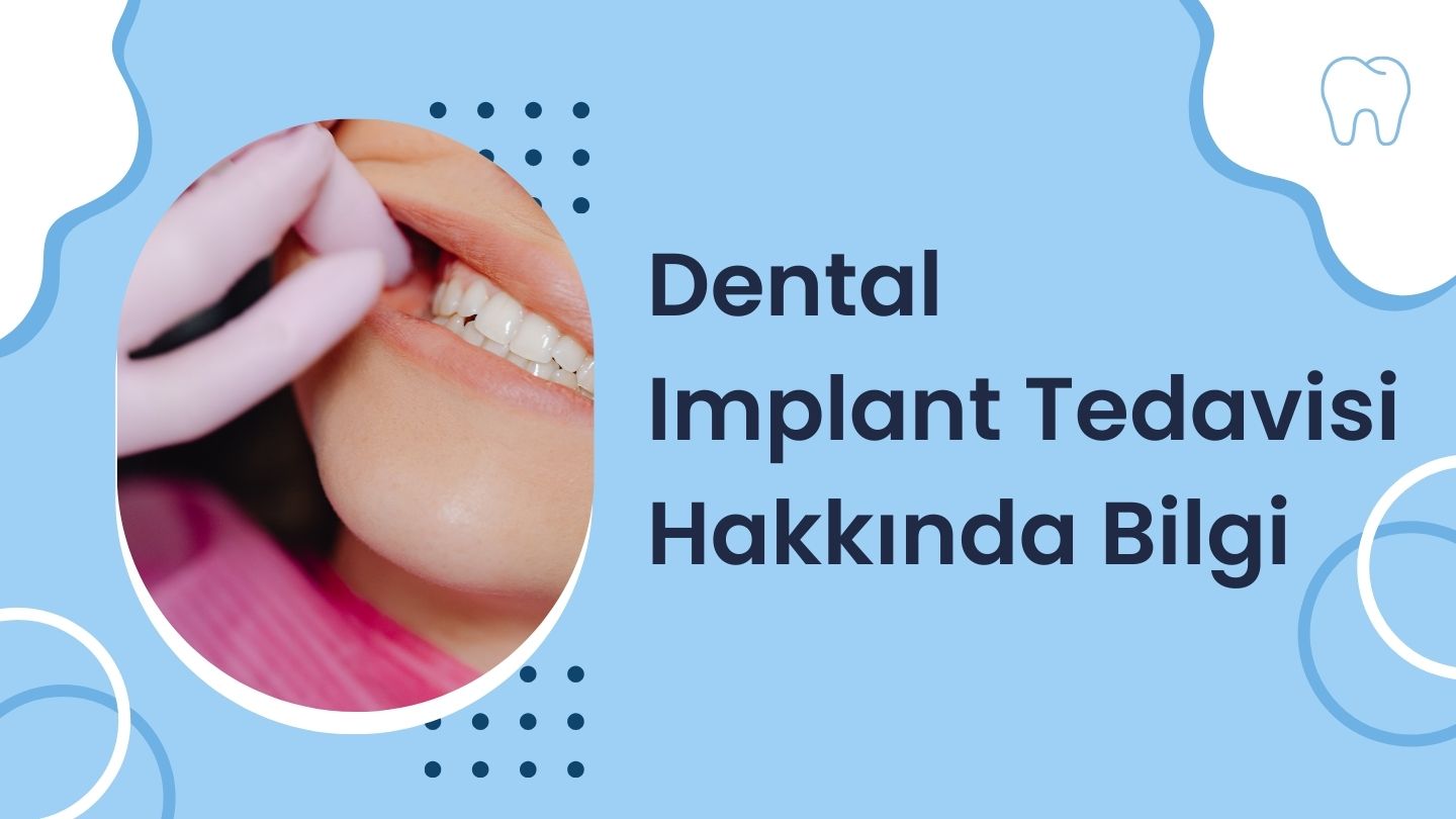 Dental Implant Tedavisi Hakkında Bilgi