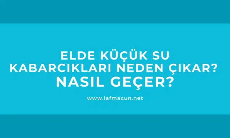 Elde Küçük Su Kabarcıkları Neden Çıkar? Nasıl Geçer? 1 Elde Küçük Su Kabarcıkları Neden Çıkar? Nasıl Geçer?
