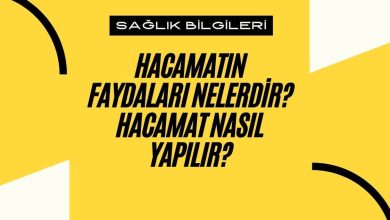 Hacamatın Faydaları Nelerdir? Hacamat Nasıl Yapılır? 1 Hacamatın Faydaları Nelerdir? Hacamat Nasıl Yapılır?